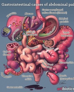 HICH:What do you think is the most common cause of abdominal pain?
#stomache