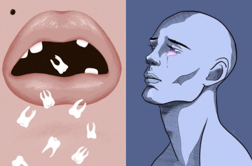 HICH:Would you rather lose all your teeth or all of your hair?