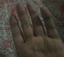HICH:How many fingers are there?