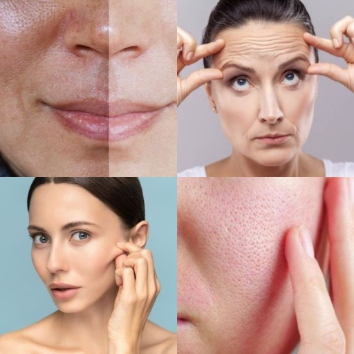HICH:What is the main benefit of using niacinamide acid in skincare?