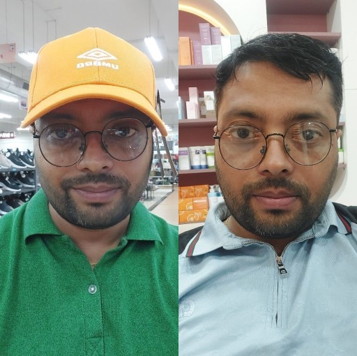 HICH:With cap or without cap? Vote please💙
